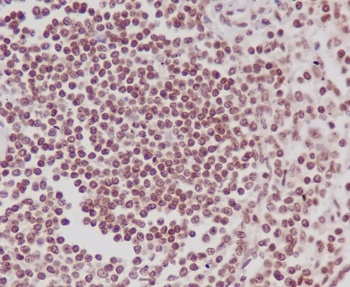 Phospho-POLR2A (S5) Rabbit Monoclonal Antibody