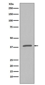 Phospho-IKB alpha NFKBIA/IKB Rabbit Monoclonal Antibody
