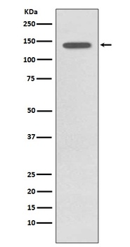 Phospho-TrkB NTRK2 Rabbit Monoclonal Antibody
