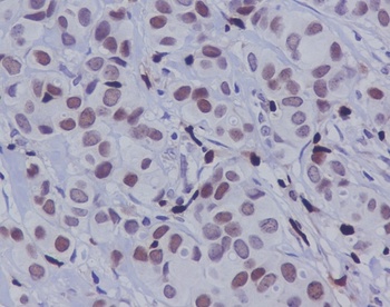 Phospho-c-Jun (S63) Rabbit Monoclonal Antibody