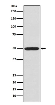 Phospho-PKA R2 PRKAR2A/PKA Rabbit Monoclonal Antibody