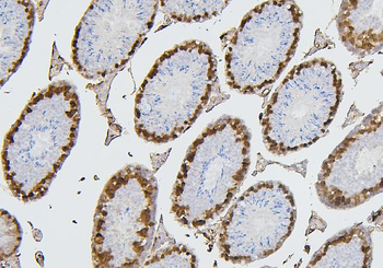 CDK1 Antibody (monoclonal, 2G11)