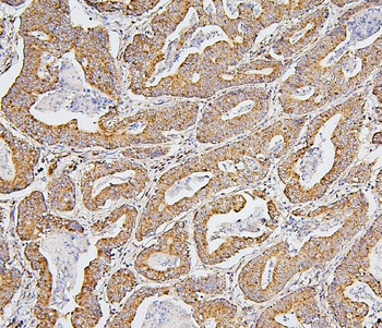 BAK/BAK1 Antibody (monoclonal, 4C2)