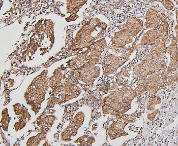BAK/BAK1 Antibody (monoclonal, 4C2)