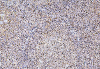 BAK/BAK1 Antibody (monoclonal, 4C2)