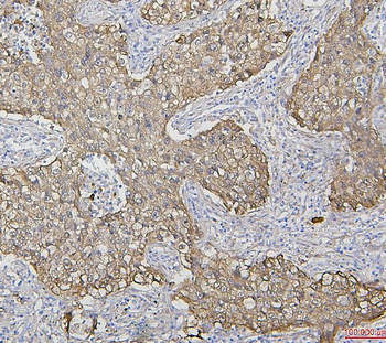 Hsp27/HSPB1 Antibody (monoclonal, 3H3)