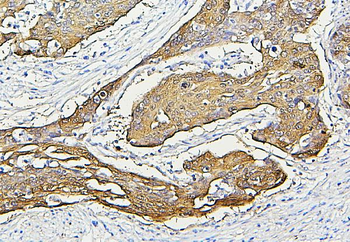 Hsp27/HSPB1 Antibody (monoclonal, 3H3)