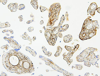Hsp27/HSPB1 Antibody (monoclonal, 3H3)