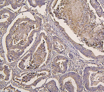 IRS1 Mouse Monoclonal Antibody