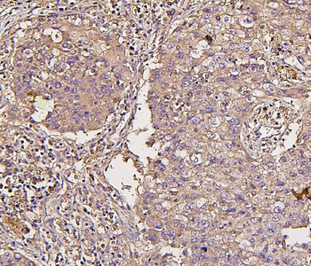 IRS1 Mouse Monoclonal Antibody