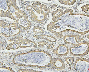 Hsp60/HSPD1 Antibody (monoclonal, 6G2)