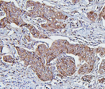 Hsp60/HSPD1 Antibody (monoclonal, 6G2)