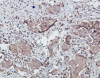 SDHB Mouse Monoclonal Antibody