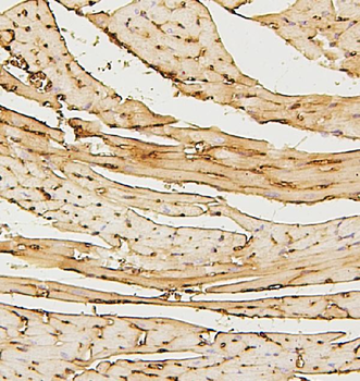 SDHB Mouse Monoclonal Antibody