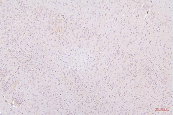 HMGB1 Antibody (monoclonal, 5H3)