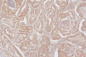 HMGB1 Antibody (monoclonal, 5H3)