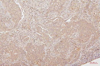 HMGB1 Antibody (monoclonal, 5H3)