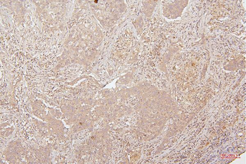 HMGB1 Antibody (monoclonal, 5H3)