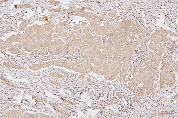 HMGB1 Antibody (monoclonal, 5H3)