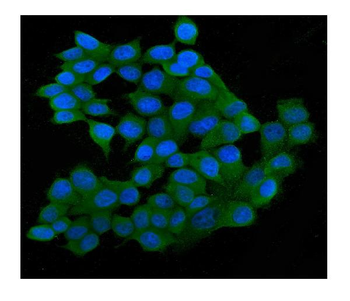 SQSTM1/p62 Antibody (monoclonal, 3H11)