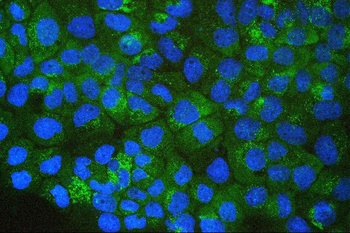 SQSTM1/p62 Antibody (monoclonal, 3H11)