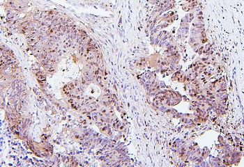 SQSTM1/p62 Antibody (monoclonal, 3H11)