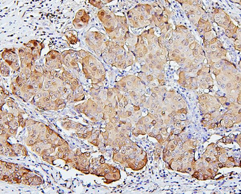 SQSTM1/p62 Antibody (monoclonal, 3H11)