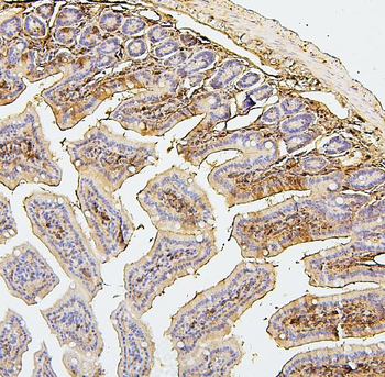 SQSTM1/p62 Antibody (monoclonal, 3H11)