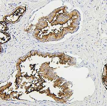 RAB27A Antibody (monoclonal, 2F5)