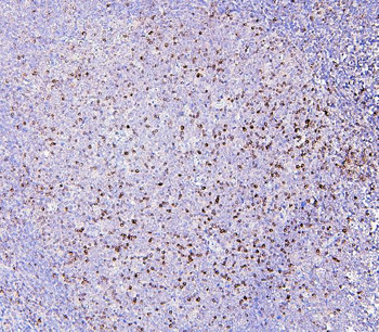 RAB27A Antibody (monoclonal, 2F5)