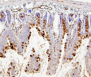 RAB27A Antibody (monoclonal, 2F5)