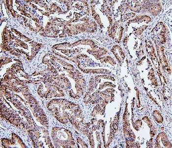 Hsp105/HSPH1 Antibody (monoclonal, 3D10)