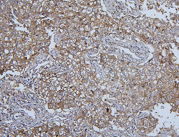 Hsp105/HSPH1 Antibody (monoclonal, 3D10)