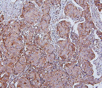 Hsp105/HSPH1 Antibody (monoclonal, 3D10)