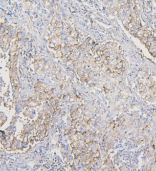 COPE Antibody (monoclonal, 9B6)