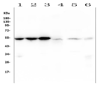 Desmin Mouse Monoclonal Antibody
