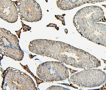 COMT Antibody (monoclonal, 15C10)