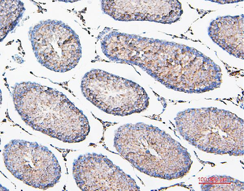 COMT Antibody (monoclonal, 15C10)