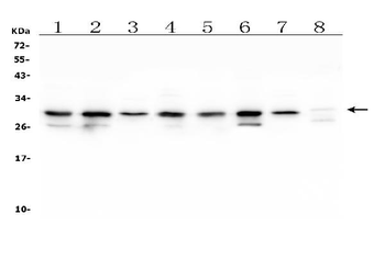 COMT Antibody (monoclonal, 15C10)