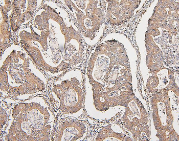 COMT Antibody (monoclonal, 15C10)