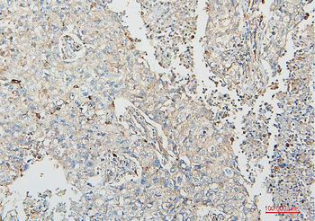 COMT Antibody (monoclonal, 15C10)