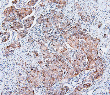 COMT Antibody (monoclonal, 15C10)