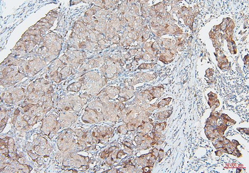 COMT Antibody (monoclonal, 15C10)