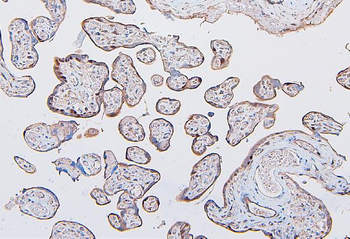 COMT Antibody (monoclonal, 15C10)