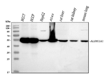 Retinal dehydrogenase 1 ALDH1A1 Antibody