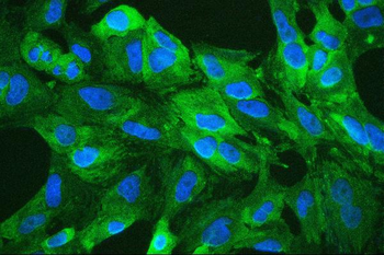 Retinal dehydrogenase 1 ALDH1A1 Antibody