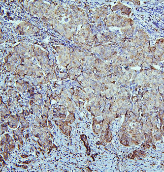 Retinal dehydrogenase 1 ALDH1A1 Antibody