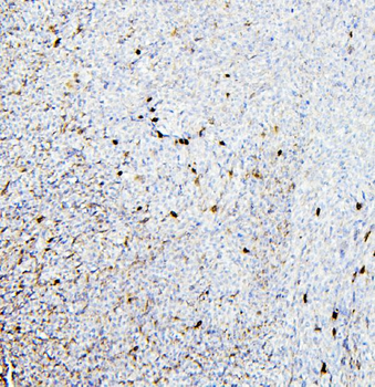 Retinal dehydrogenase 1 ALDH1A1 Antibody