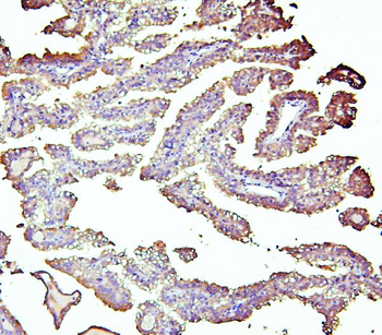 Retinal dehydrogenase 1 ALDH1A1 Antibody