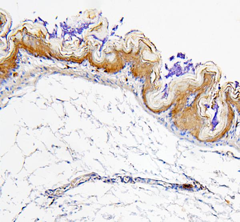 Retinal dehydrogenase 1 ALDH1A1 Antibody